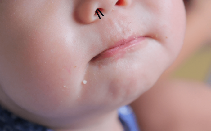 子どもの 鼻毛 はいつから気になる おすすめの処理方法はこれ